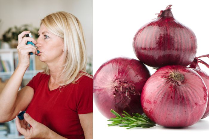 A photo of a variety of onions, which contain proteins that can cause an allergic reaction in some people.