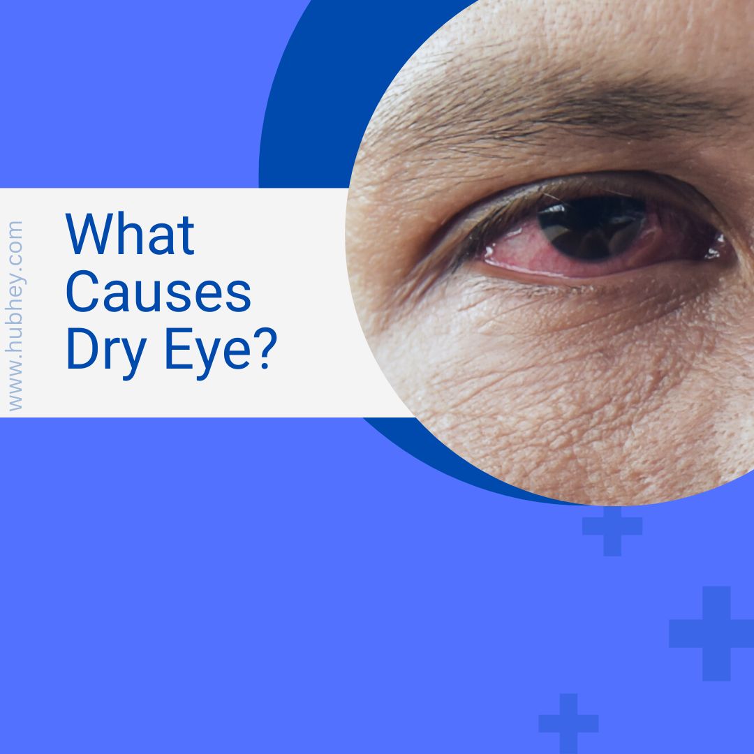 Dry Eyes-7 Symptoms, Reason, And Cure | Hubhey: For Everyone